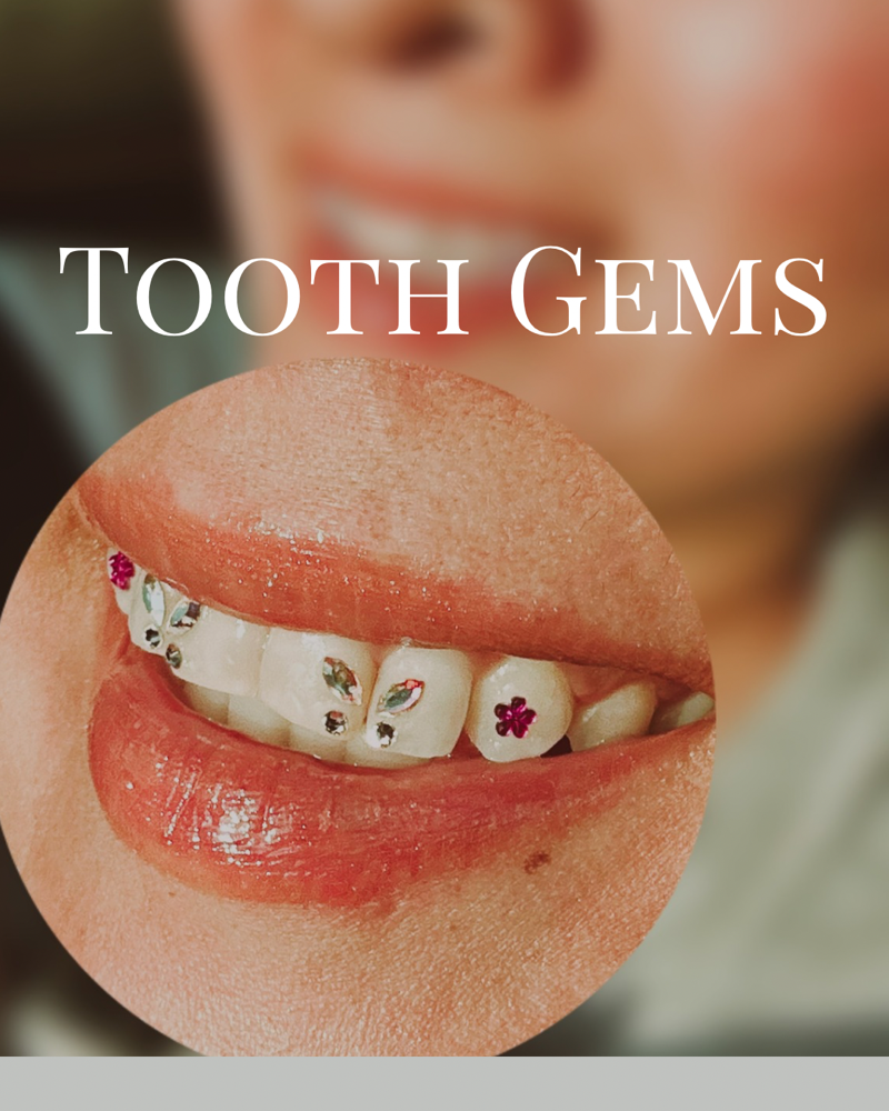 Tooth Gems