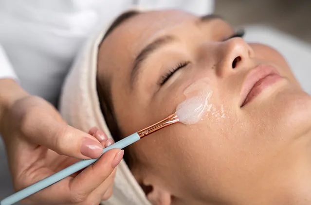 Maintenance Chemical Peel