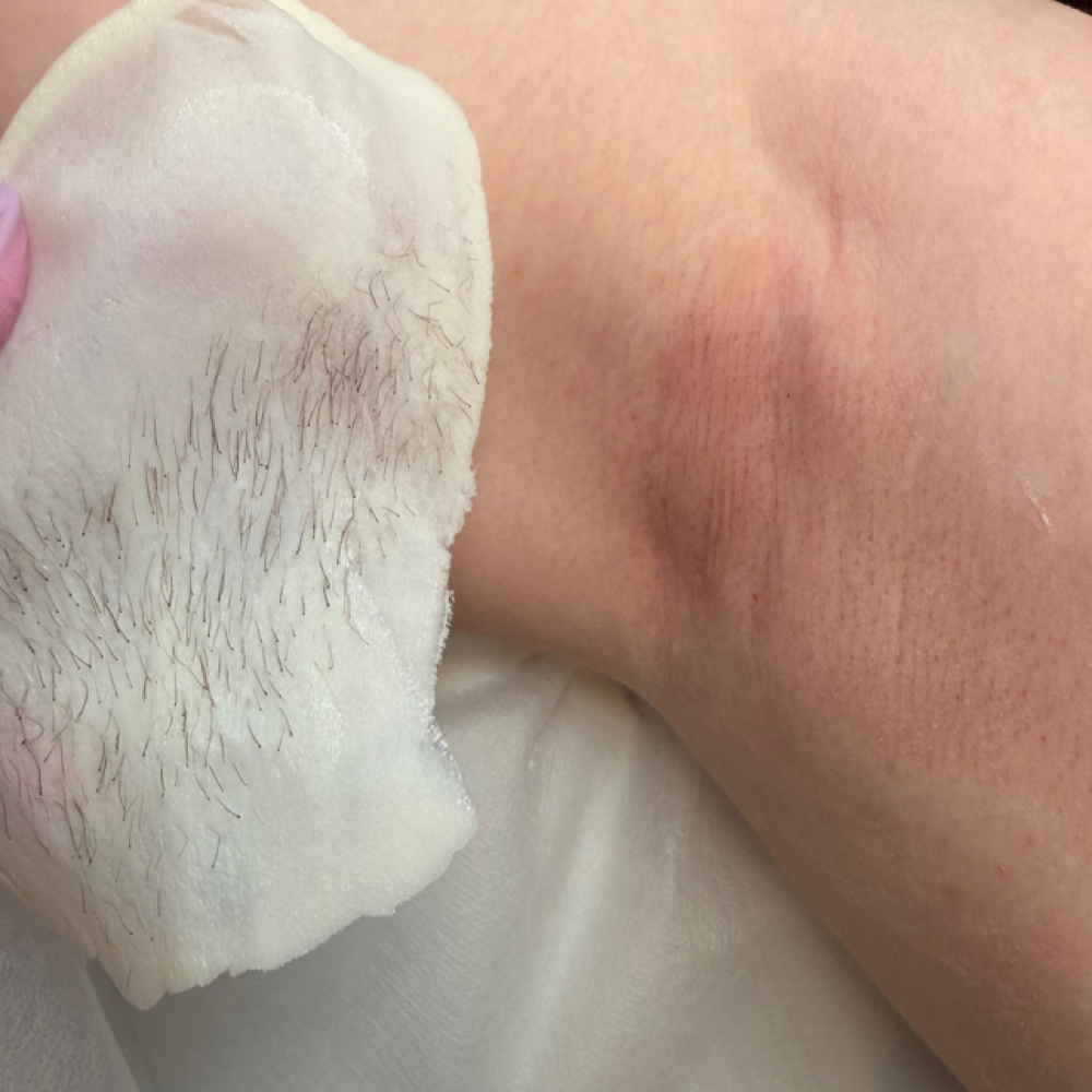 Brazilian + Armpit Wax at Skin Babe Studio LLC in Fernandina Beach, FL