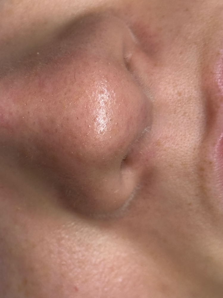 Extra Extractions - add on service