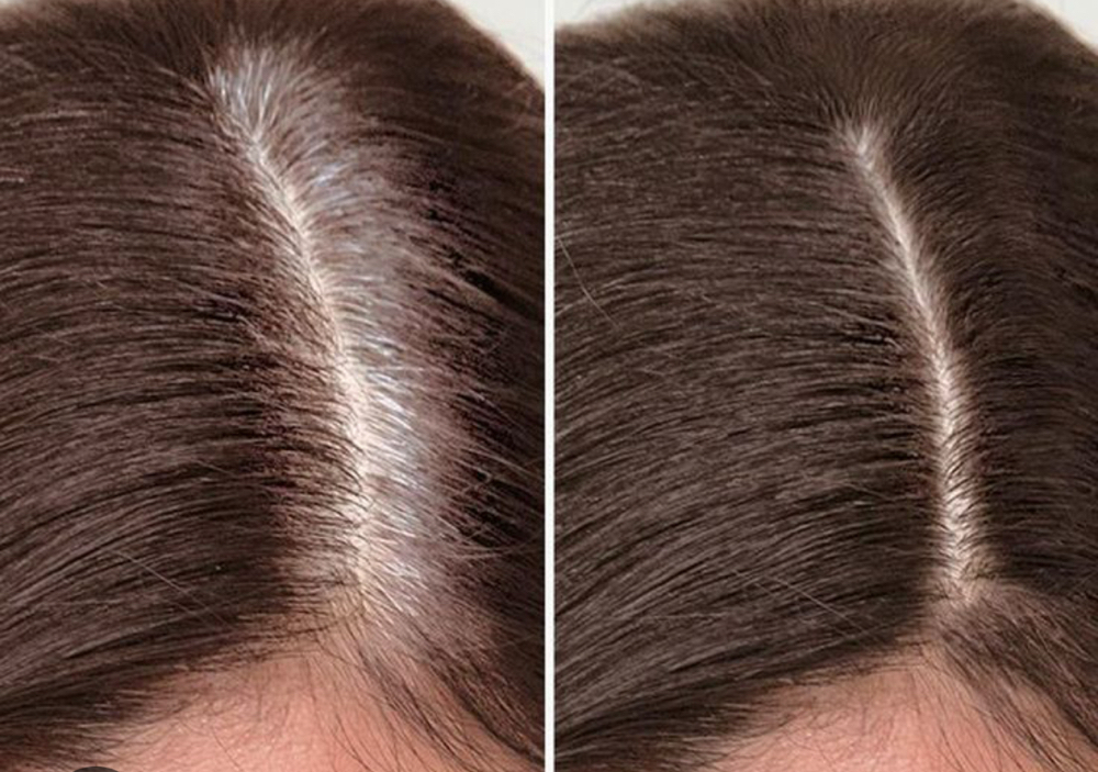 Root Touch Up Only