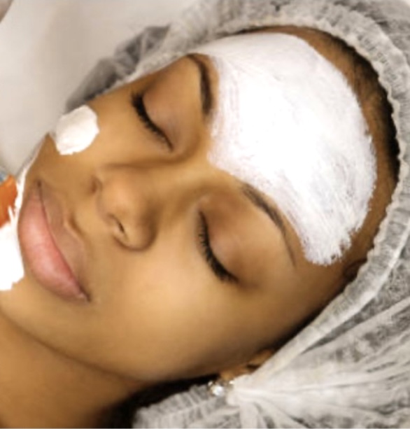 BlemishBlitz Facial at Flawless By Fabiola in Baldwin, NY