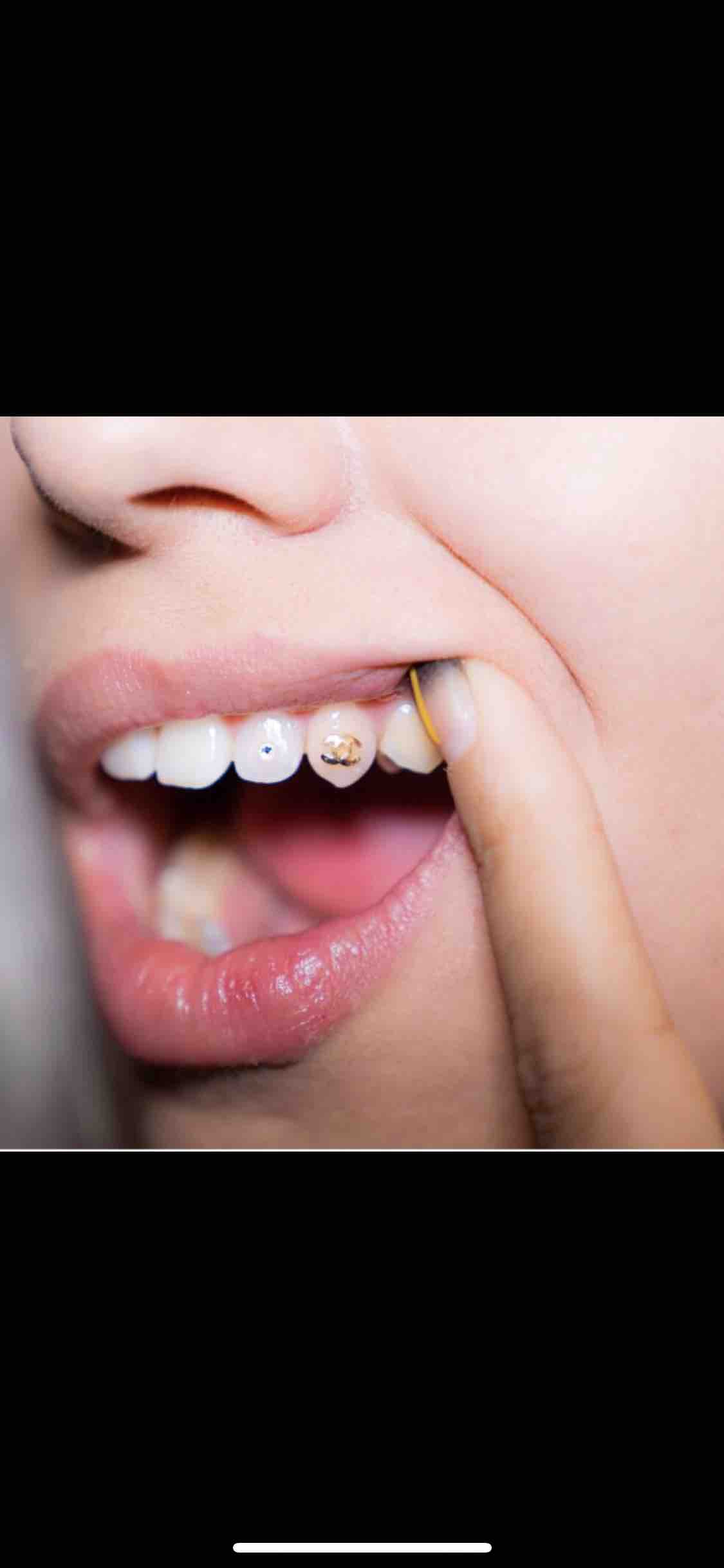 Tooth Jewels