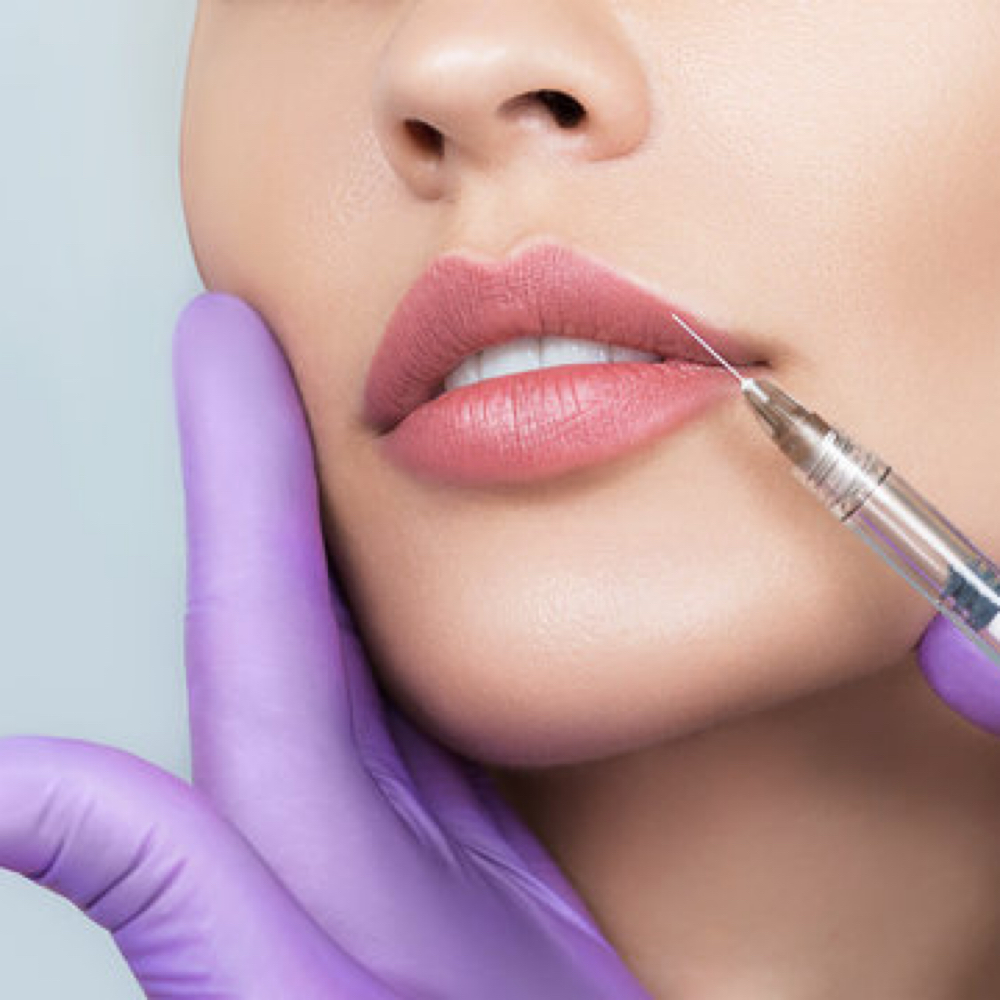 MINI LIP PLUMP at Jay Michelle Aesthetics & Wellness in Lake Jackson, TX
