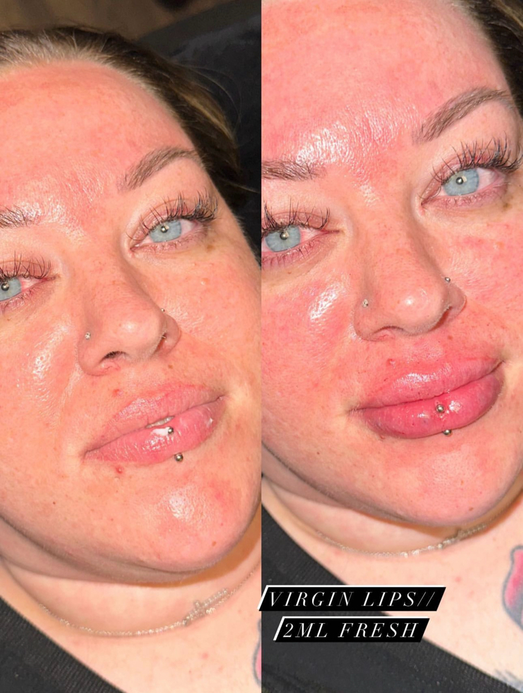 Needle Free Filler (2ML) at Holy Beauty Co in Kennewick, WA