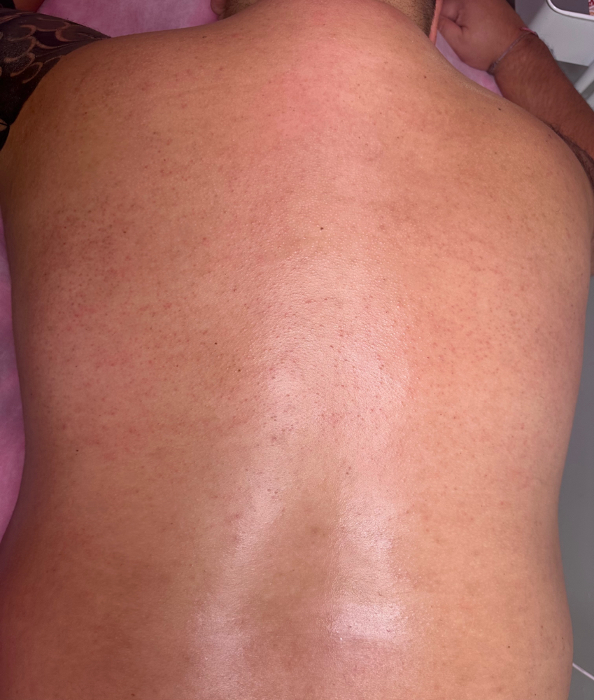 Back