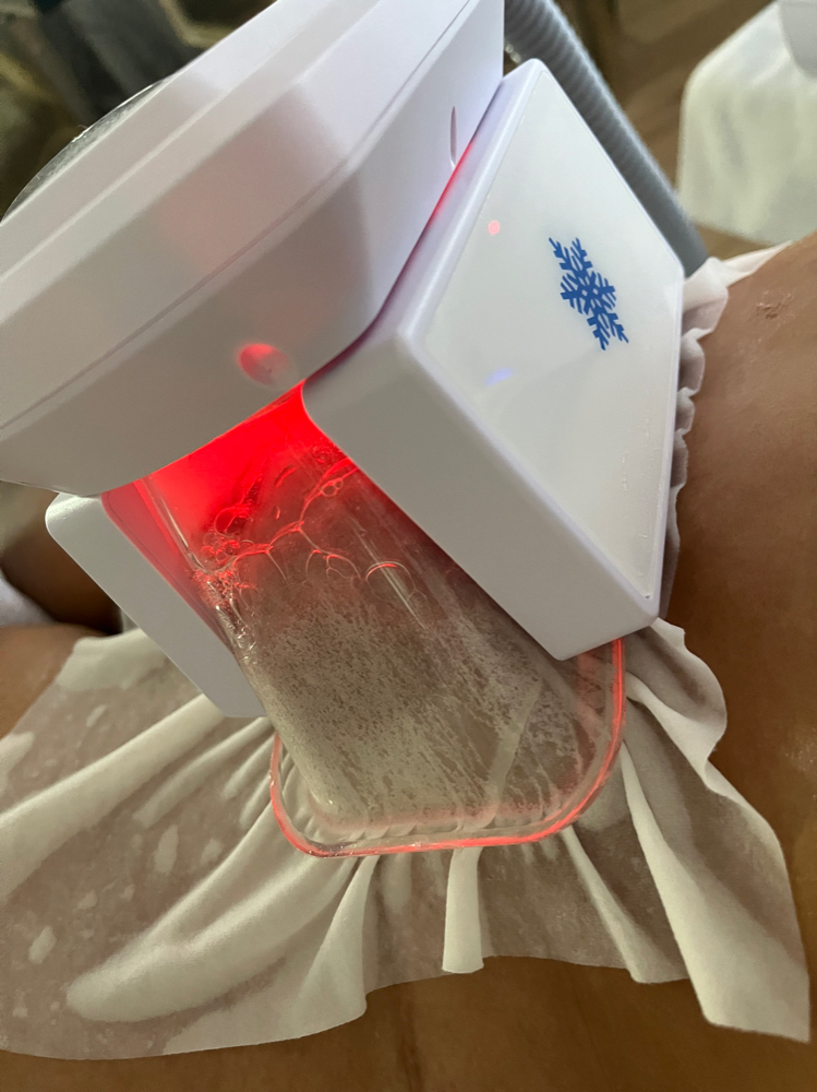 Coolsculpting