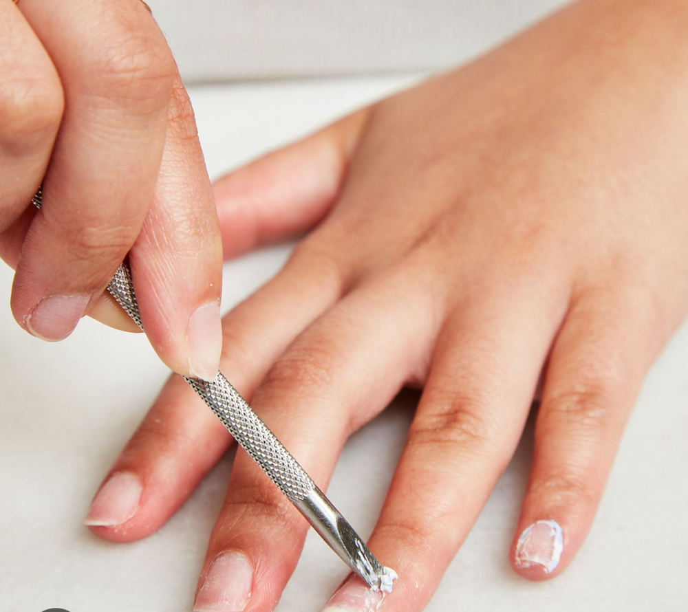 Nail Removal