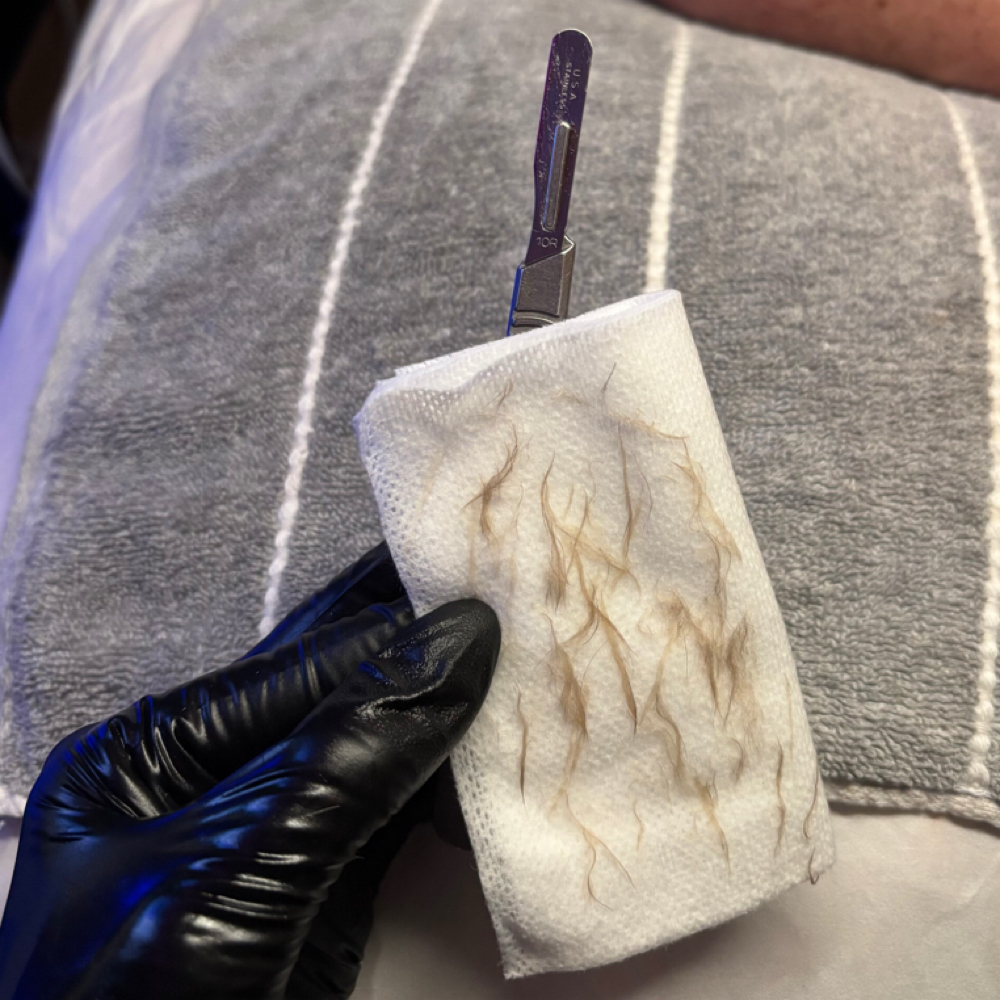 Express Dermaplane at Thrive Esthetics, LLC in Bel Air, MD