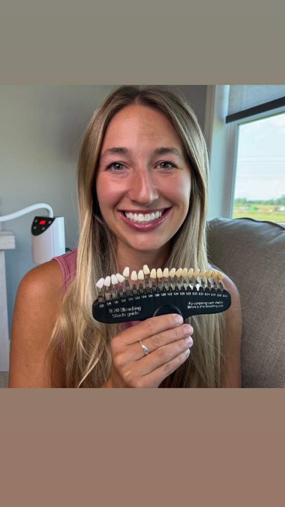 Luxury Teeth Whitening Treatments