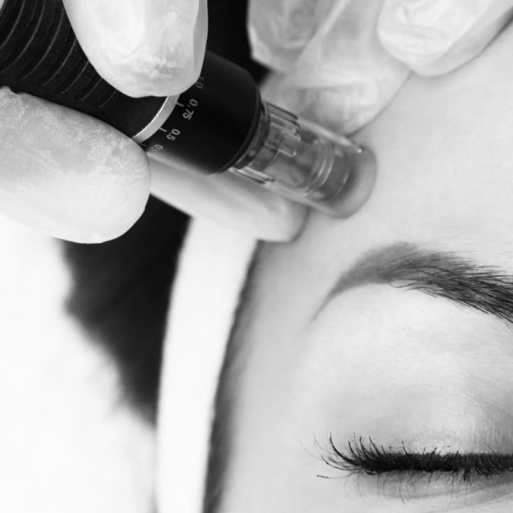 Salmon DNA Infusion Add-On at Victoria Michelle Aesthetics LLC in Kings Park, NY