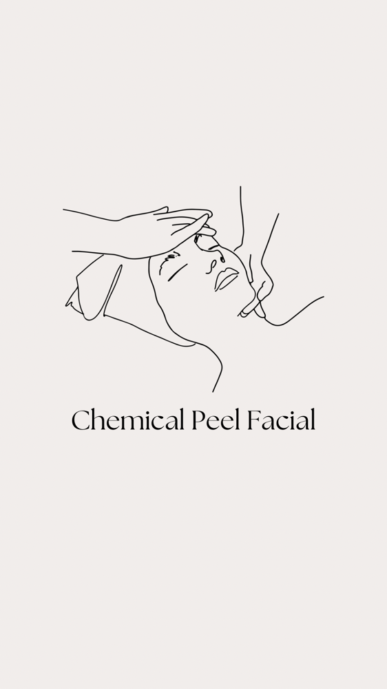 Chemical Peel Facial