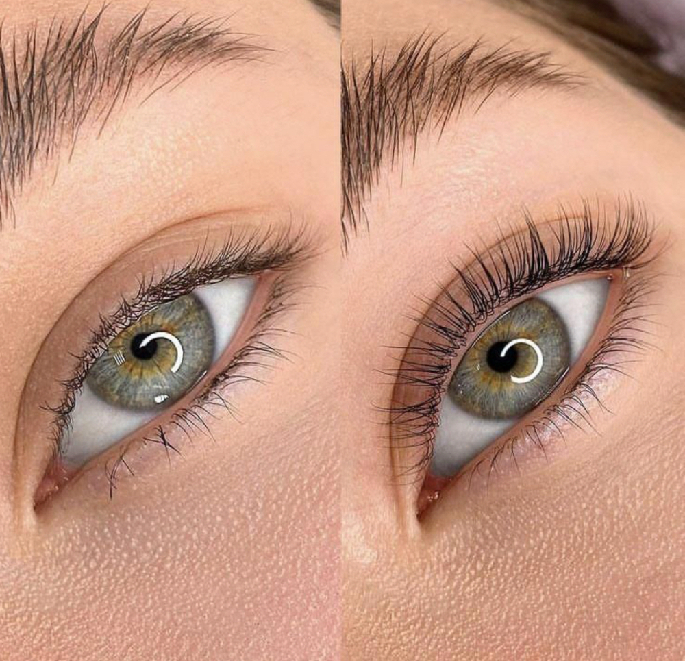Classic Set at Nola Esthetics in St James, NY