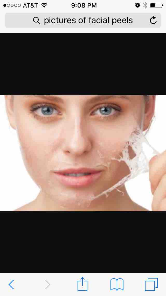 Ultra Peel 1 Or 2 Rejuvenate Facial