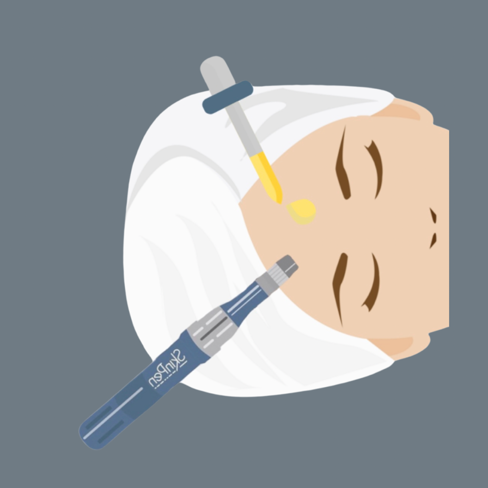 Microneedling