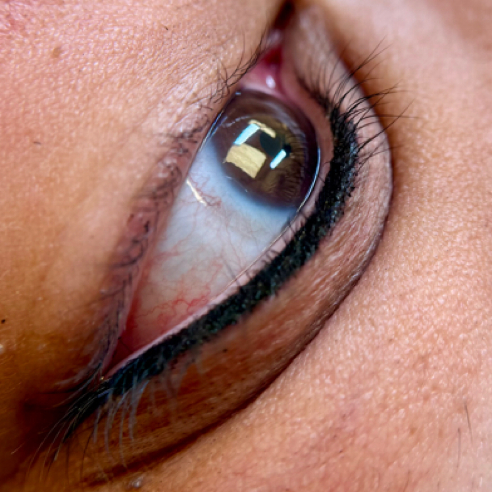 Lash line Enhancement