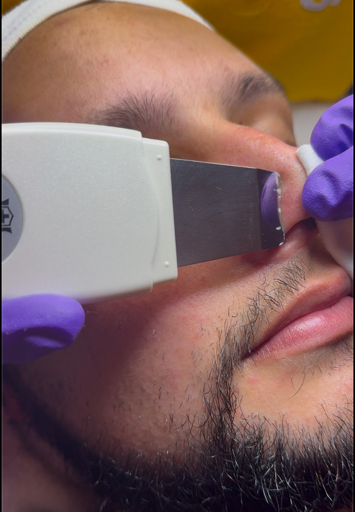 Ultrasonic Extractions