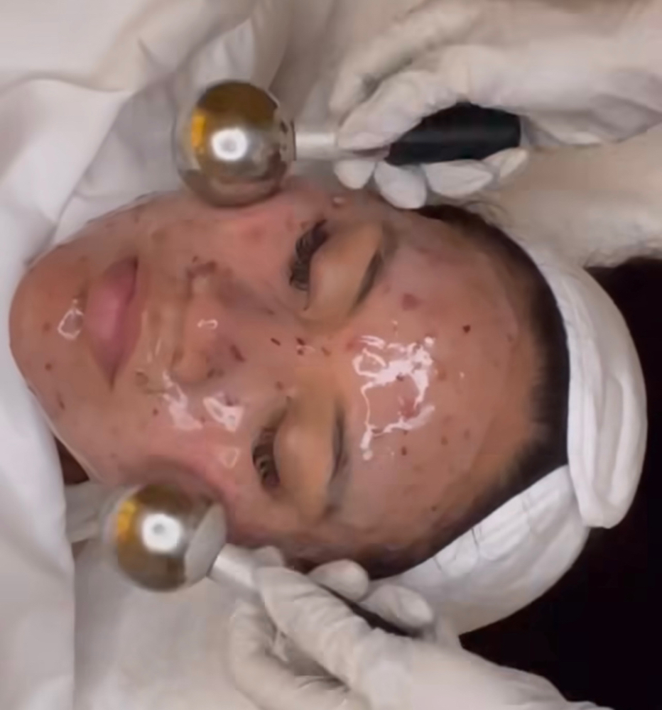 Custom Facial