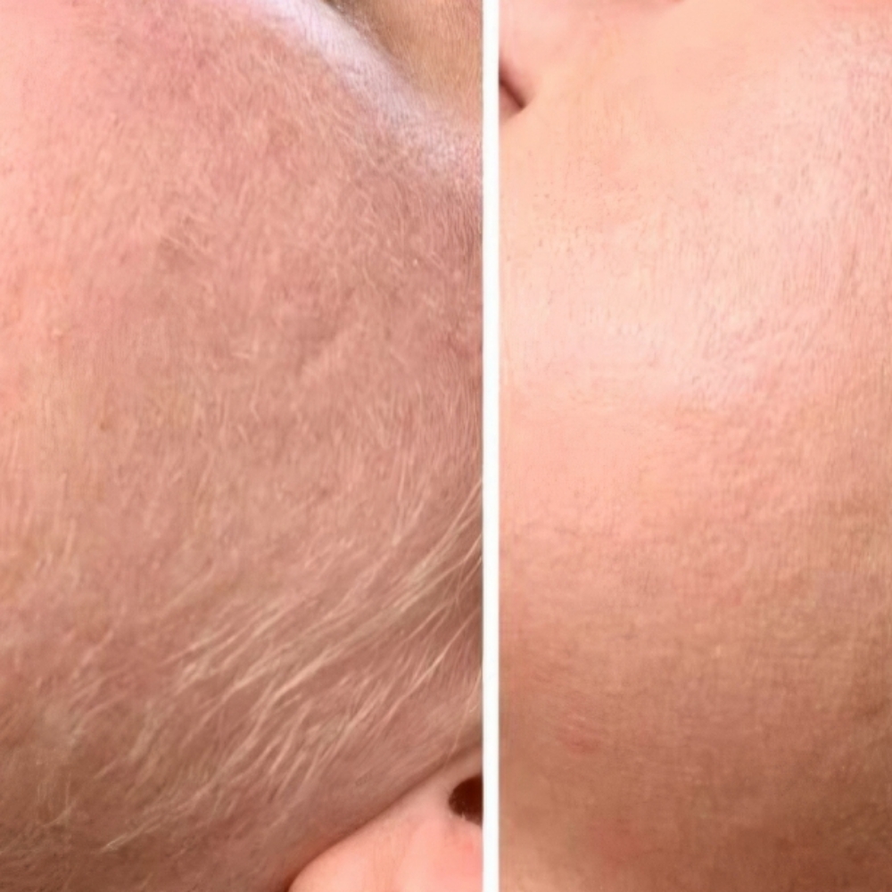 Full Face Wax at Entouch Day Spa  |   La Pine's Premier Facial Spa & Waxing Studio in La Pine, OR