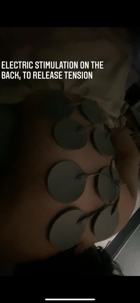 Electric Stimulation