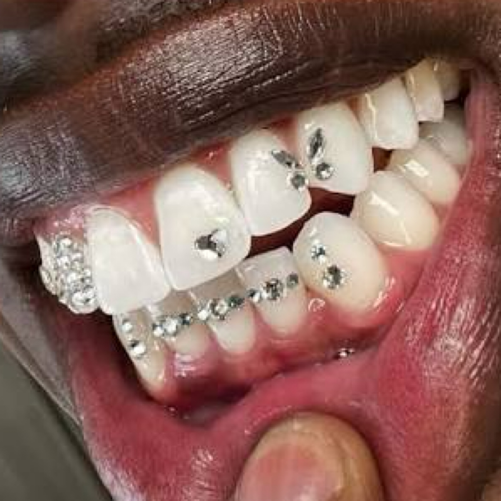 Tooth Gemz 💎✨ at Goddess Lux in Wichita Falls, TX