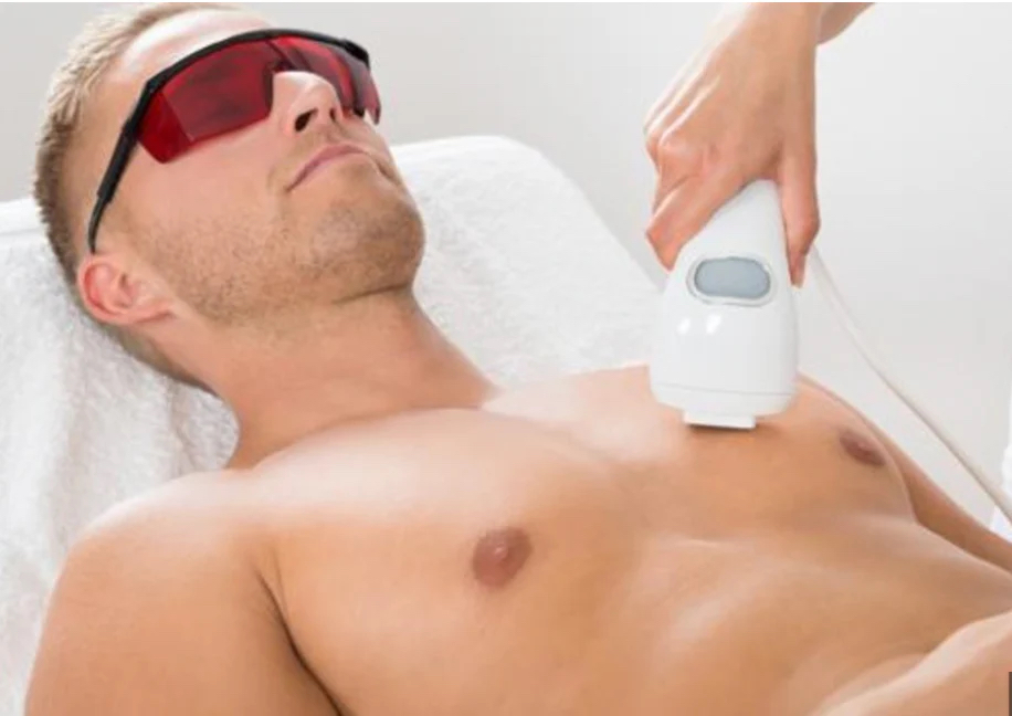 Chest IPL Hair Removal