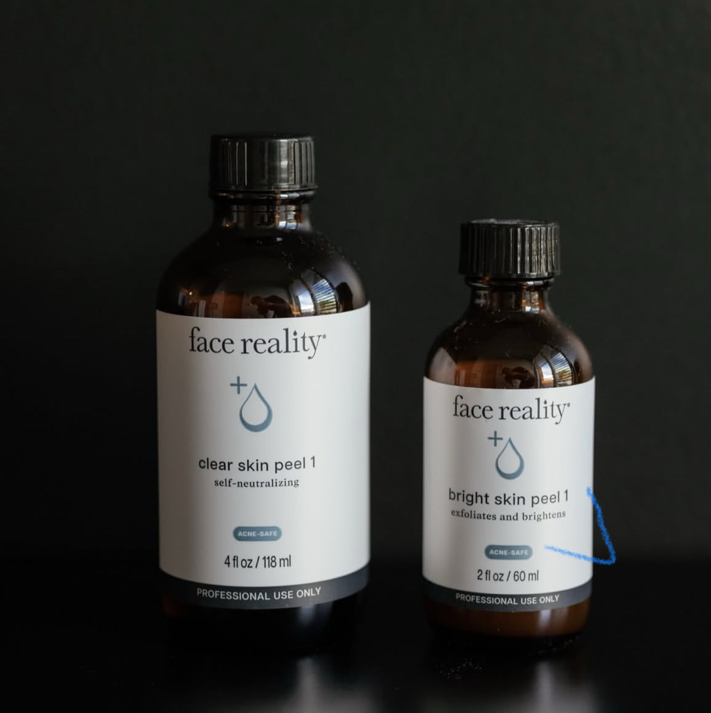 Custom Chemical Peel