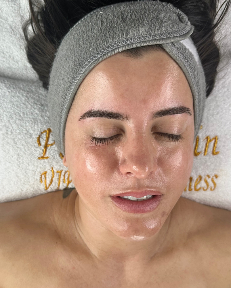 💎TOP Diamond Facial