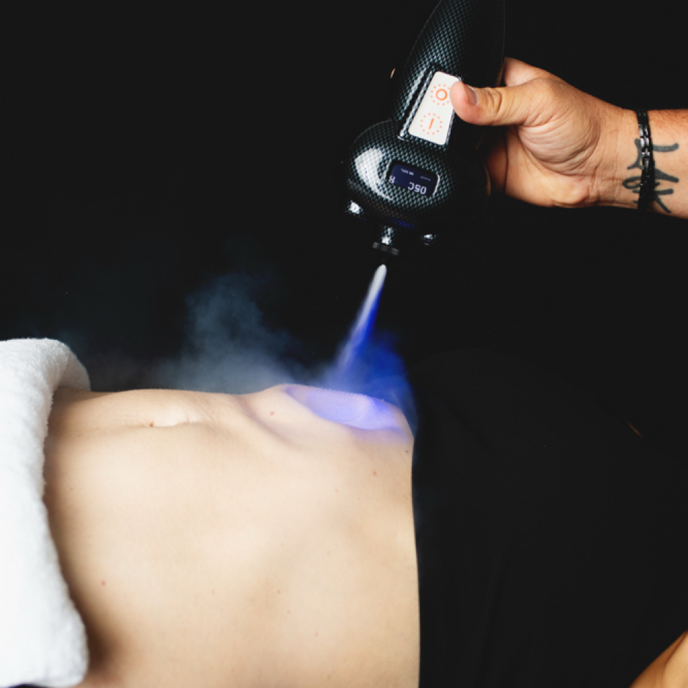 CRYO BODY SCULPT (single Session) at Mi Amor Aesthetics Spa in Paso Robles, CA