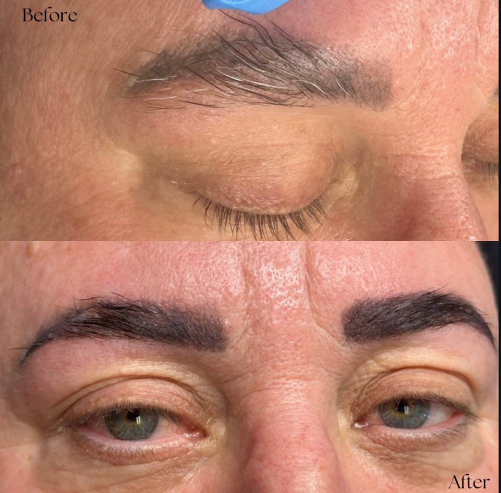 Eyebrow Lamination at Mana Aesthetics in Las Vegas, NV
