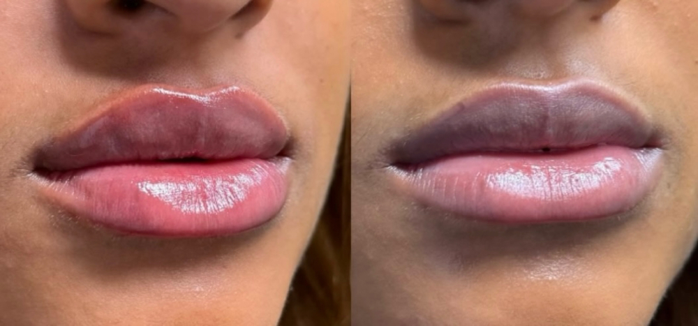 Natural Look