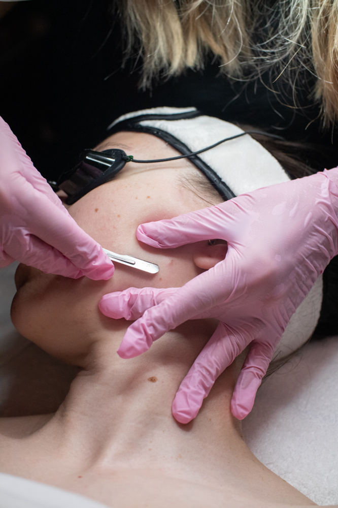 Dermaplaning