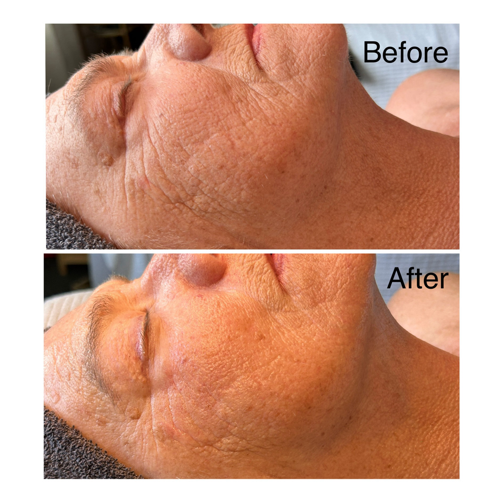 Hop+ Collagen Renewal Facial