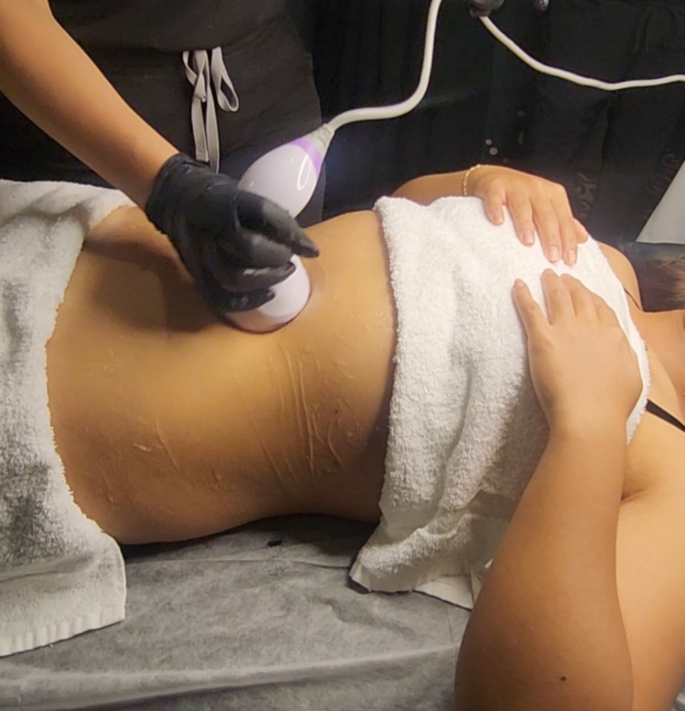 Ultrasonic Cavitation+RF W/vacuum