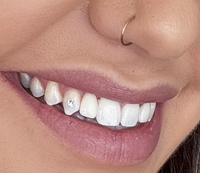 Two Teeth Gems