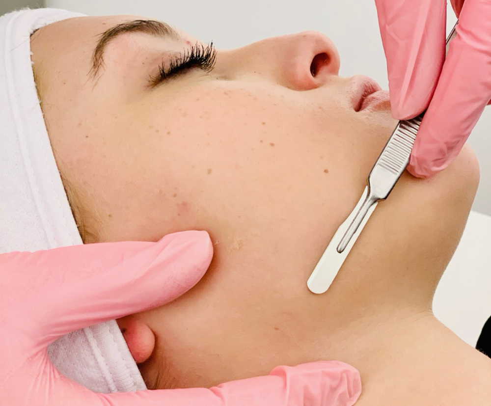 Dermaplane Add On