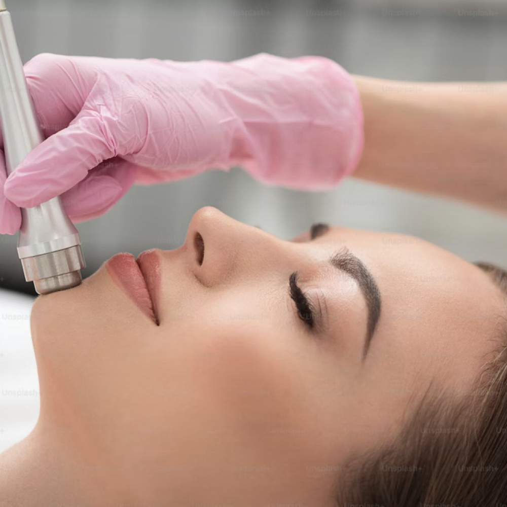 Microdermabrasion (Add-On Service) at Signature A Aesthetics in Menomonie, WI