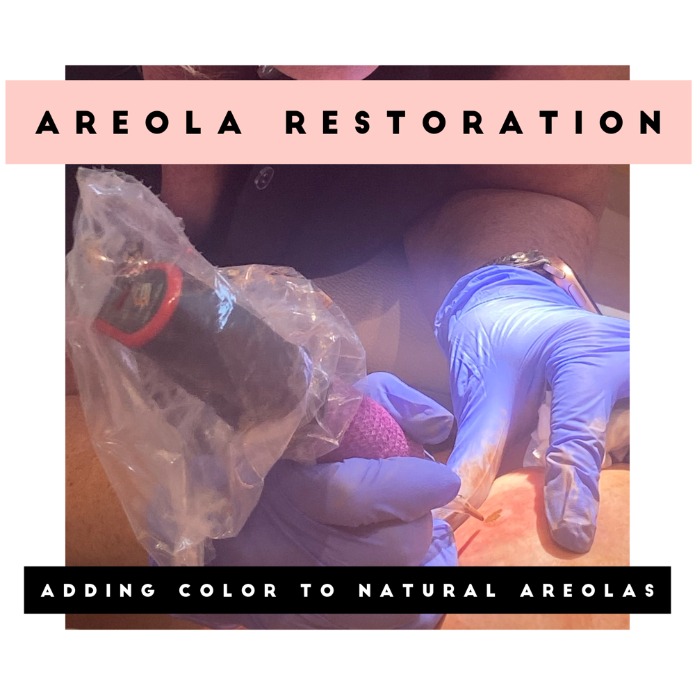 Areola Restoration