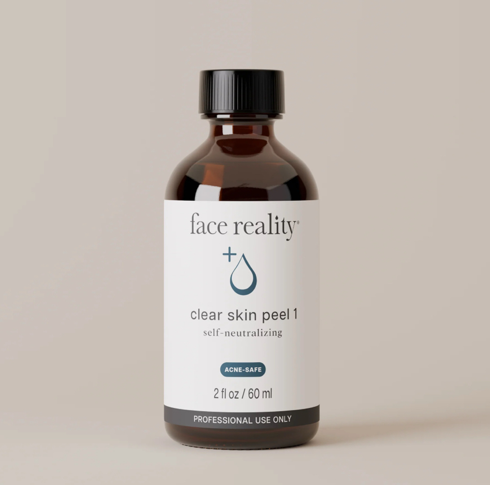 Face Reality: Chemical Peel