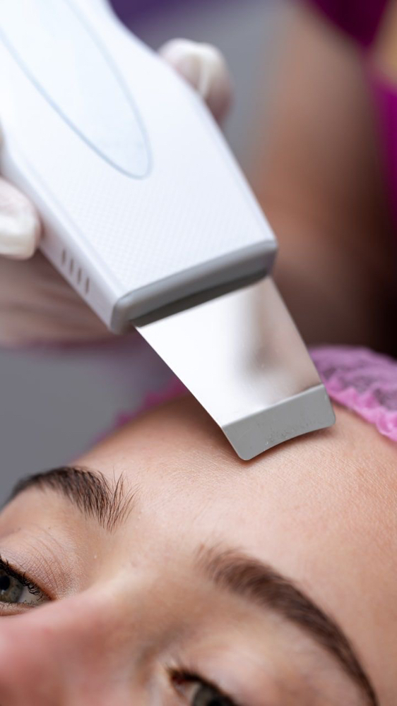 ''Catch-me-up'' Acne Facial