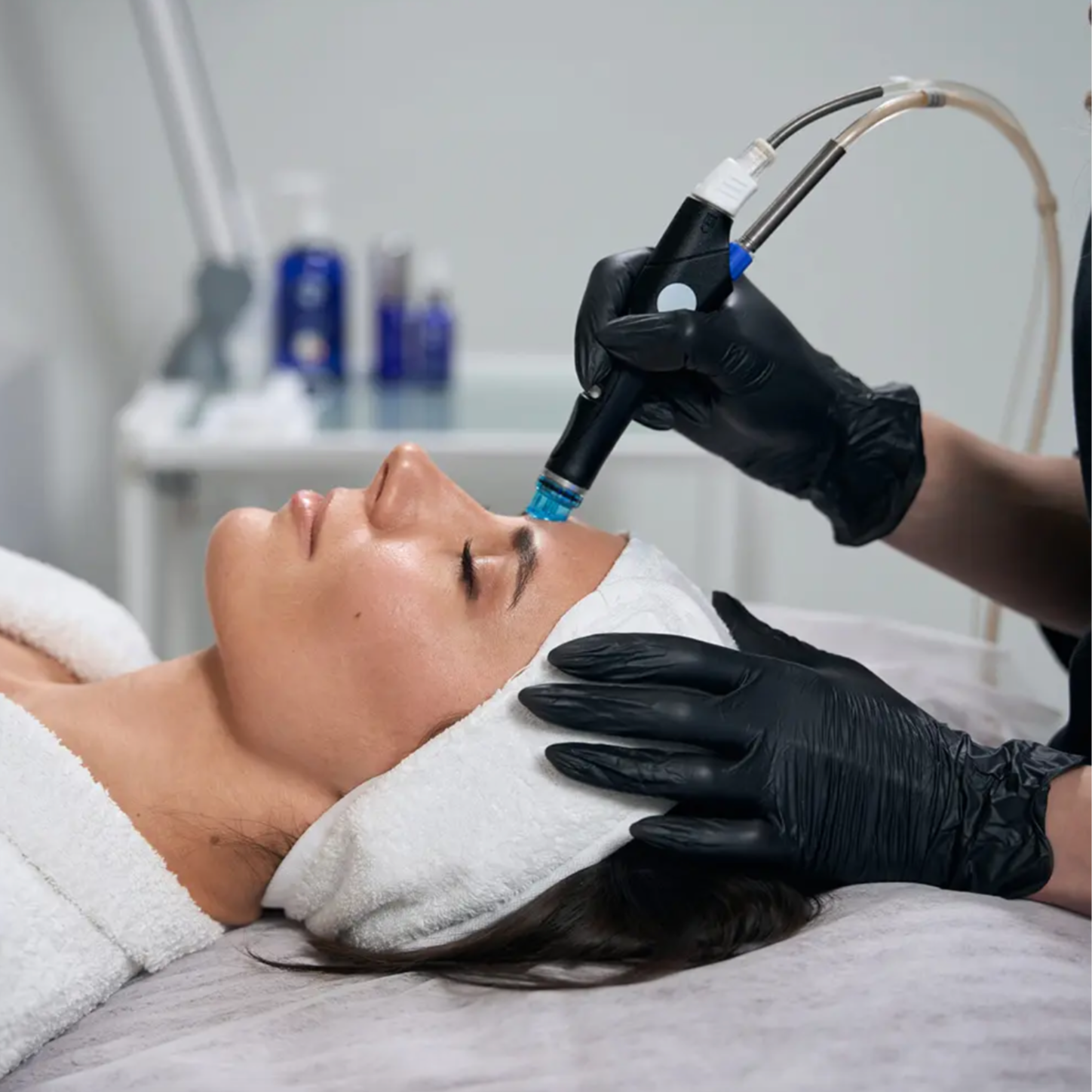 Hydrodermabrasion Facial at Skin By Esty in Murrieta, CA