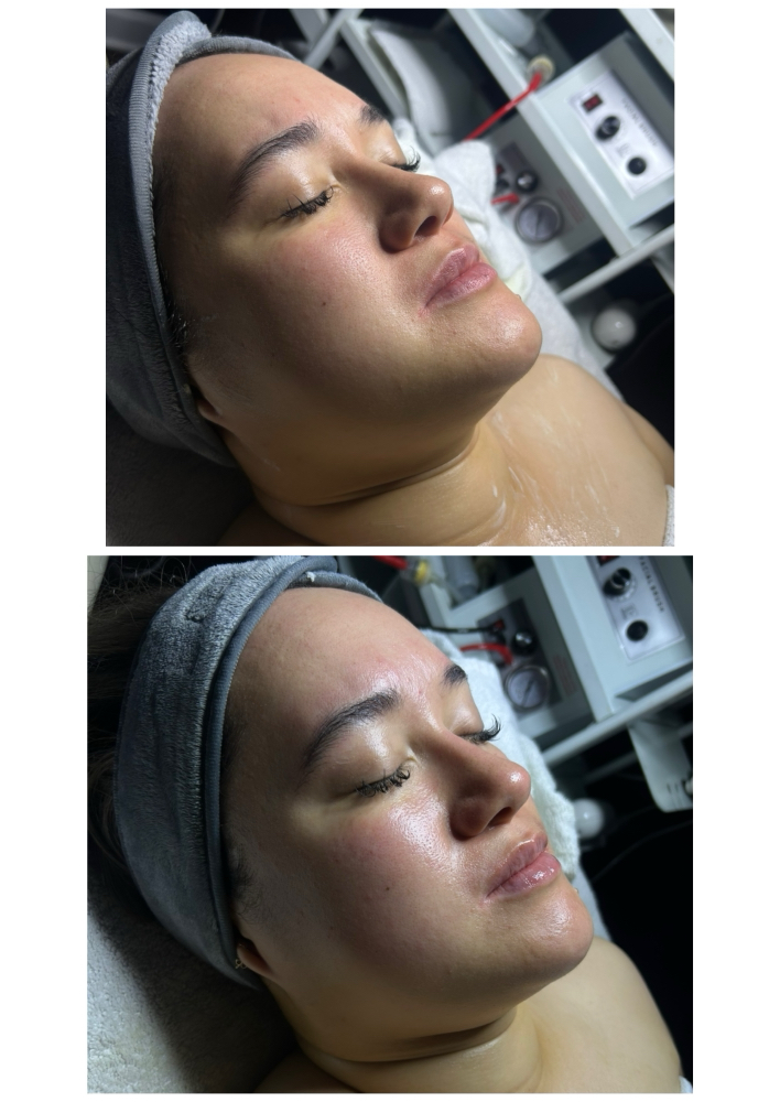 Lymphatic Drainage Facial