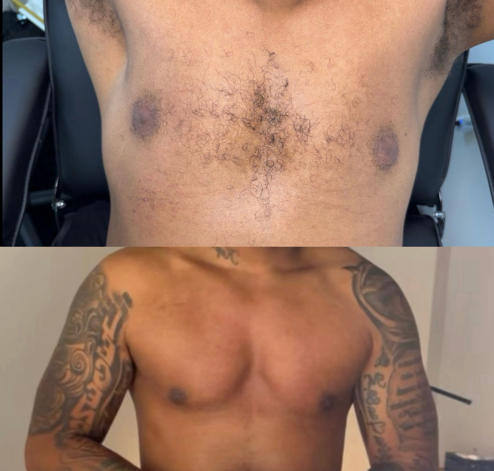 Men Chest Wax Hair Removal