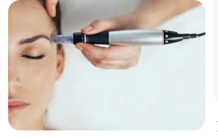 Micro Needleling