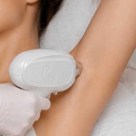 Underarms Laser Hair Removal at La VILNA in Jacksonville, FL