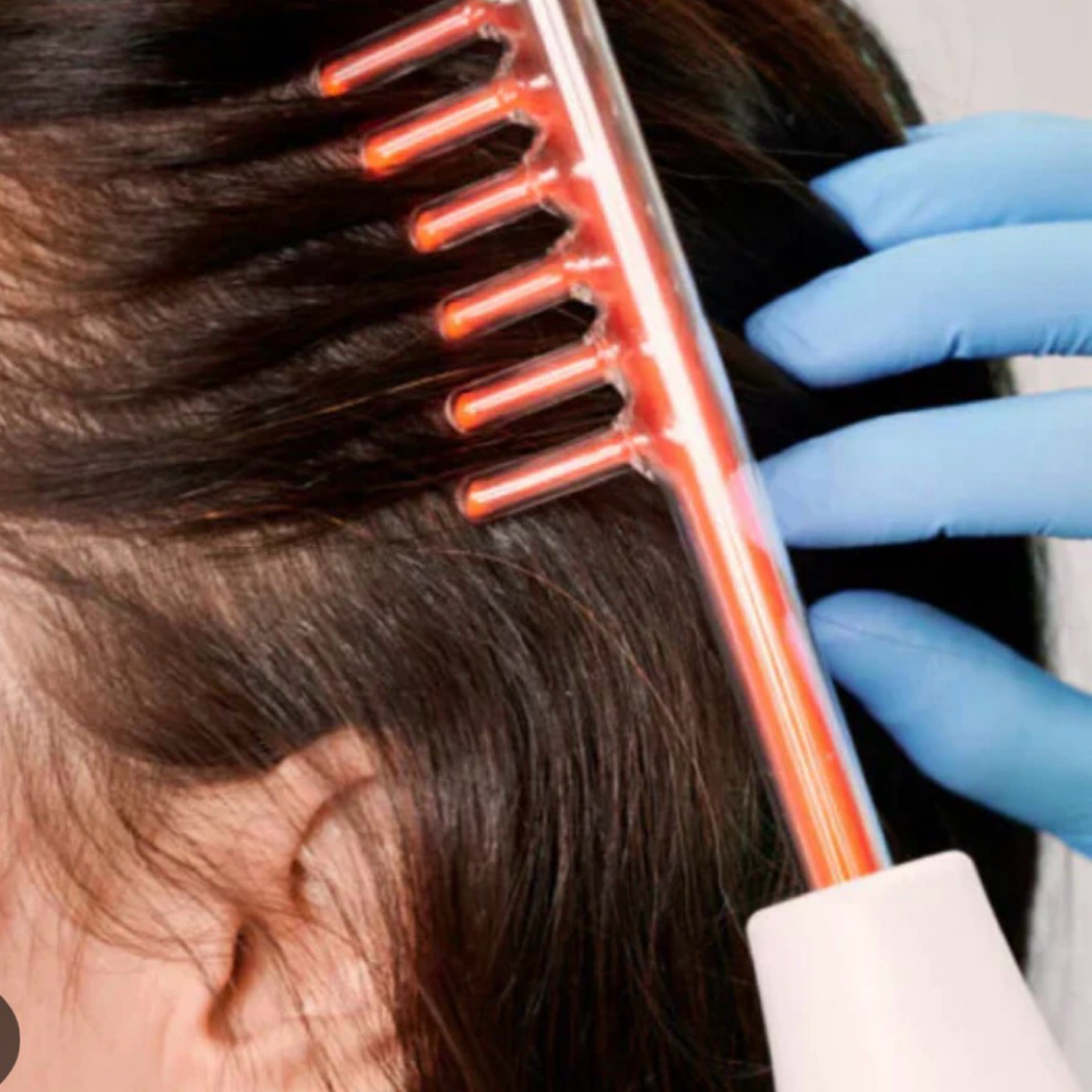 Hair Loss Help at Chelsea Rook in Oakland, CA