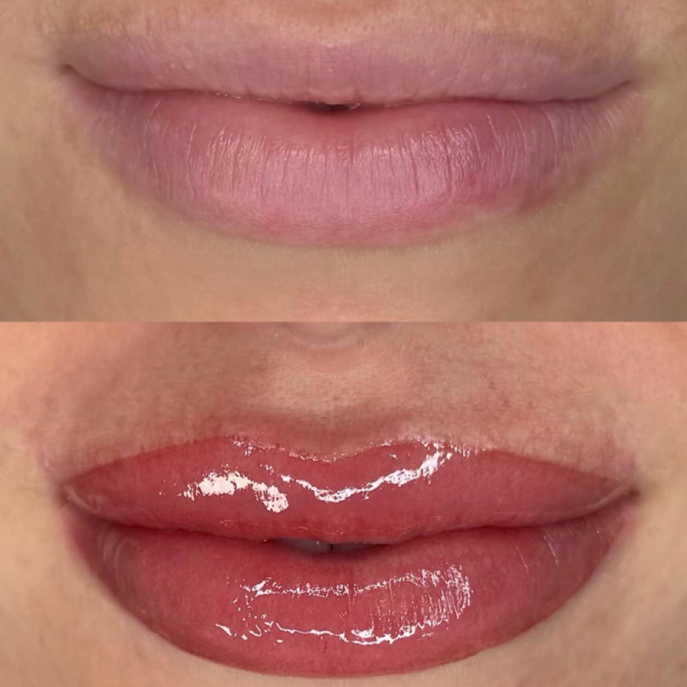 Lip Blush (One Color) at Posy Aesthetics in Dallas, TX