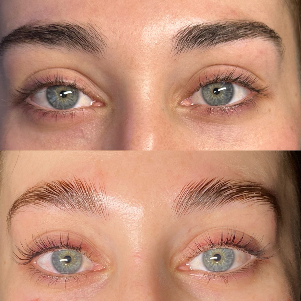 Brow Lamination