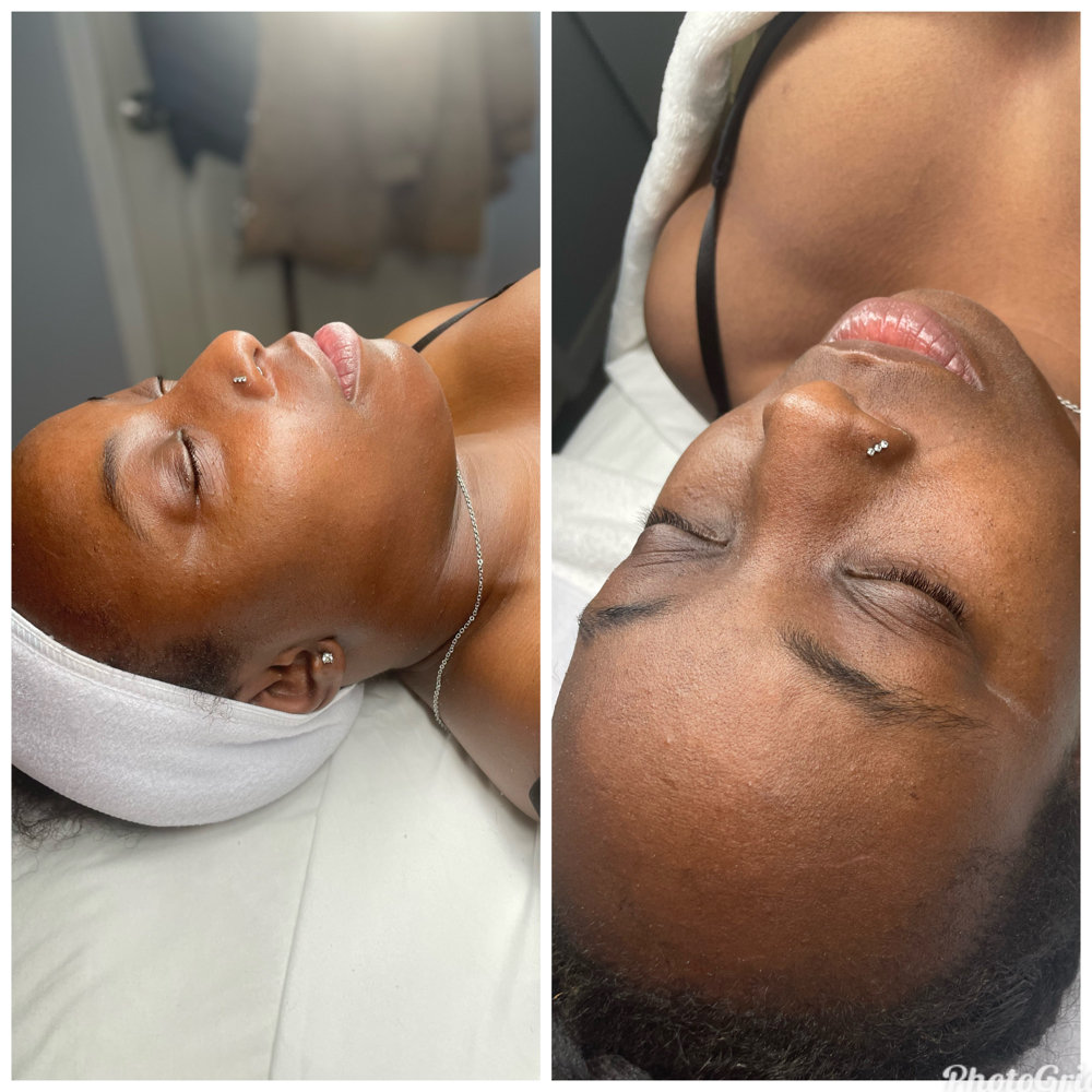 Customized Facial