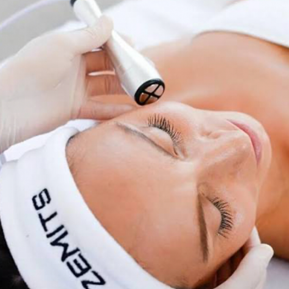 RF Skin Tightening Treatment at Glow by Bilo in Ipswich, MA